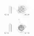 Fig. 09 - Vertebral facet joint prosthesis and method of fixation