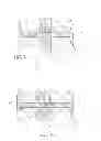 Fig. 22 - Vertebral facet joint prosthesis and method of fixation