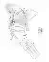 Fig. 02 - Reverse shoulder prosthetic