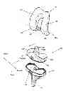 Fig. 01 - Prosthetic joint