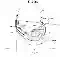 Fig. 06 - Prosthetic joint