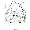 Fig. 08 - Prosthetic joint