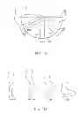 Fig. 02 - Systems and methods for providing a femoral component