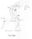 Fig. 49 - Systems and methods for providing a femoral component