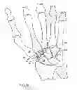 Fig. 07 - Prosthesis for the basal joint of the thumb