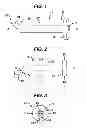 Fig. 02 - Methods and devices for preparing and implanting tissue scaffolds