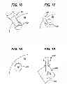 Fig. 07 - Methods and devices for preparing and implanting tissue scaffolds