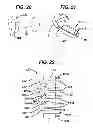Fig. 08 - Methods and devices for preparing and implanting tissue scaffolds