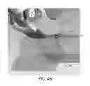 Fig. 09 - Multiple grasp prosthetic terminal device