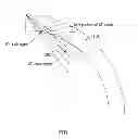 Fig. 02 - Phased array scanning into a curvature