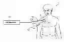 Fig. 01 - Techniques for Data Reporting in an Implantable Medical Device