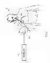 Fig. 07 - Techniques for Data Reporting in an Implantable Medical Device