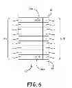 Fig. 07 - Pacemaker event queue to control device processor operating power