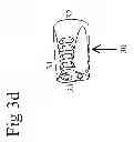 Fig. 07 - Dummy Suppressor Providing for Additional Accessories