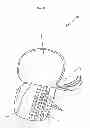 Fig. 03 - STABILIZING SYSTEM FOR A SADDLE