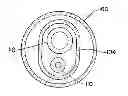 Fig. 01 - FUEL INJECTOR WITH INCREASED FEED AREA