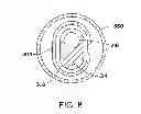Fig. 09 - FUEL INJECTOR WITH INCREASED FEED AREA