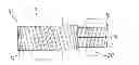 Fig. 01 - ZERO BACKLASH GEAR STRUCTURE