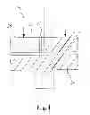 Fig. 04 - ZERO BACKLASH GEAR STRUCTURE