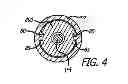 Fig. 06 - Ultra high torque device