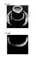 Fig. 09 - Gas generator, gas generator holder and method for manufacturing gas generator holder