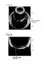 Fig. 10 - Gas generator, gas generator holder and method for manufacturing gas generator holder
