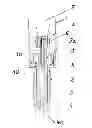 Fig. 01 - Corona ignition device