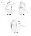 Fig. 28 - Modular pulmonary treatment system