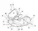 Fig. 01 - Mouth Guard