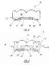 Fig. 04 - Mouth Guard