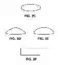 Fig. 06 - Buckling pin valve