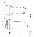 Fig. 04 - CONTAINER SEAL CLOSURE AND ASSEMBLY