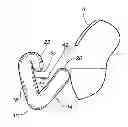 Fig. 01 - Restraints principally for inflatable evacuation systems