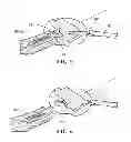 Fig. 04 - Restraints principally for inflatable evacuation systems