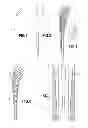 Fig. 02 - Surgical instrument for the removal of bone with sharp teeth and the method of formation thereof