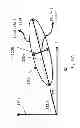 Fig. 77 - External fixator deformity correction systems and methods