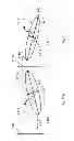 Fig. 80 - External fixator deformity correction systems and methods