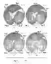 Fig. 07 - MULTI-CAMERA HEAD