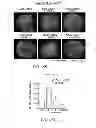 Fig. 05 - Mobilization of hematopoietic stem cells