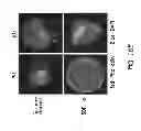 Fig. 35 - Mobilization of hematopoietic stem cells