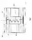 Fig. 07 - Zero backlash planetary gear train