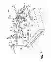 Fig. 02 - Anterior hip replacement retractor assembly