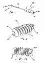 Fig. 02 - SELF-TAPPING BIOCOMPATIBLE INTERFERENCE BONE SCREW