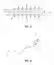 Fig. 04 - Method and device for non-invasive anatomical and systemic cooling and neuroprotection