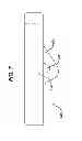 Fig. 08 - Flipping-type graft fixation device and method