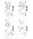 Fig. 09 - Flipping-type graft fixation device and method