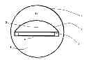 Fig. 01 - Acoustic lens