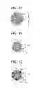 Fig. 02 - Particle and contrast agent having the particle