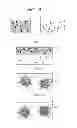 Fig. 04 - Particle and contrast agent having the particle