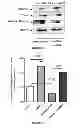 Fig. 04 - Methods of using AMPD2 inhibitors for the treatment of fatty liver, obesity and diabetes
